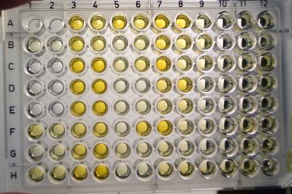 Para-tuberculosis-ELISA-KIT